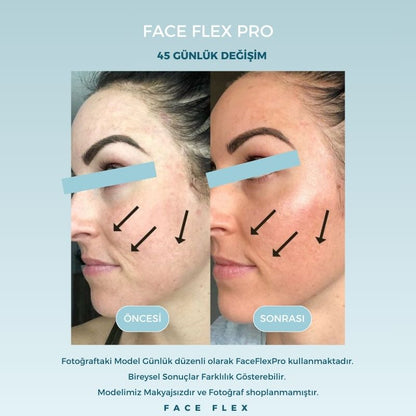 FaceFlexPro LED Işıklı Mikro Akım Yüz Sıkılaştırma Terapi Cihazı