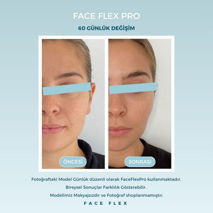 FaceFlexPro LED Işıklı Mikro Akım Yüz Sıkılaştırma Terapi Cihazı