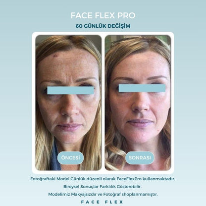 FaceFlexPro LED Işıklı Mikro Akım Yüz Sıkılaştırma Terapi Cihazı